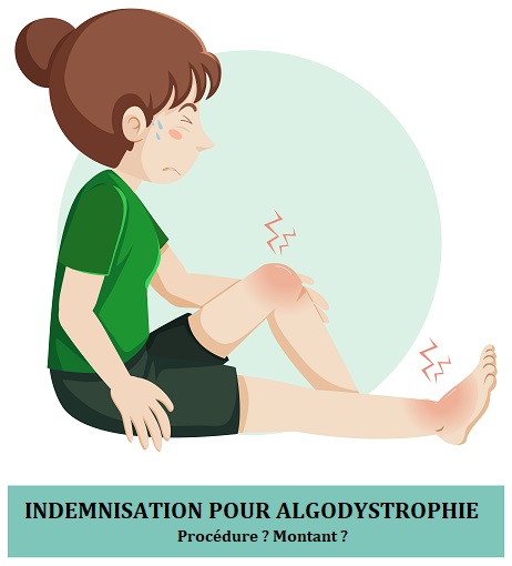 Indemnisation pour algodystrophie - MonIndemnite