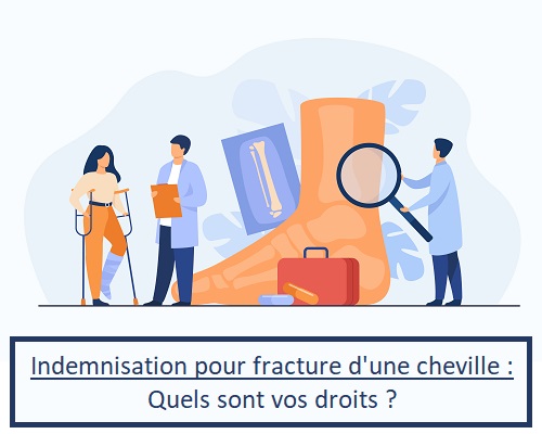 Indemnisation pour fracture cheville